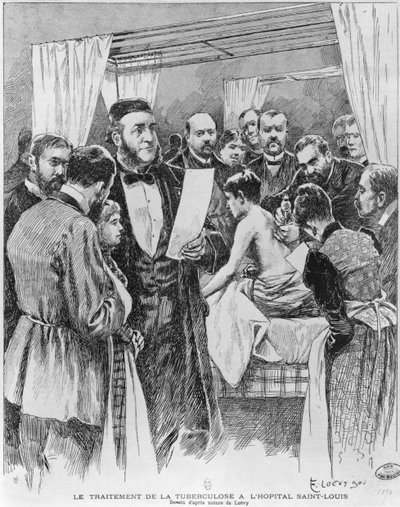 The treatment of tuberculosis at St. Louis hospital, Paris by Edward Loevy